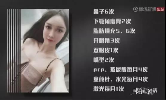 400w整容女VS和剑桥女硕士，你选谁做女票？第12张